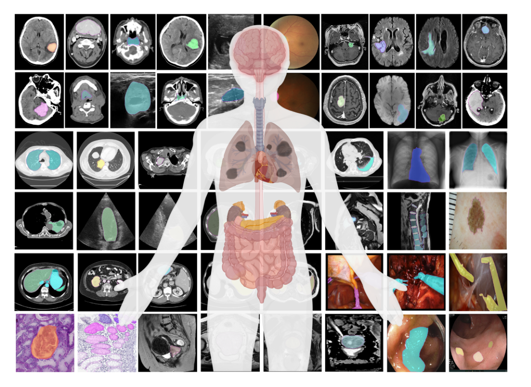 Segment Anything in Medical Images / MedSAM 的经典论文图