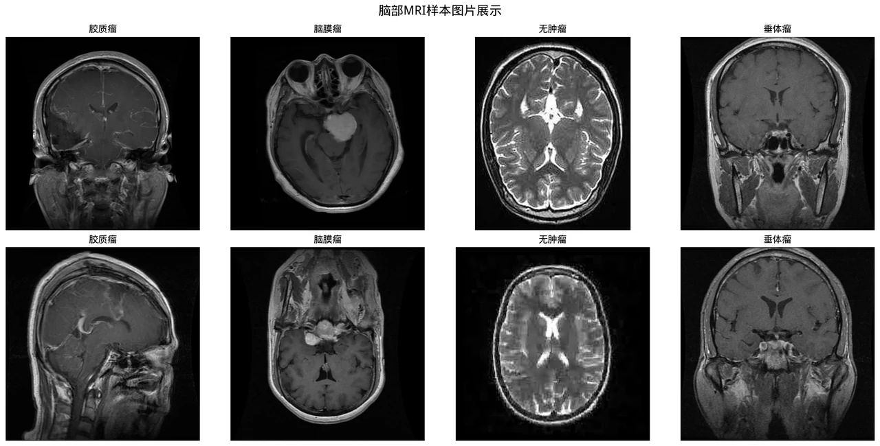 MRI 样本