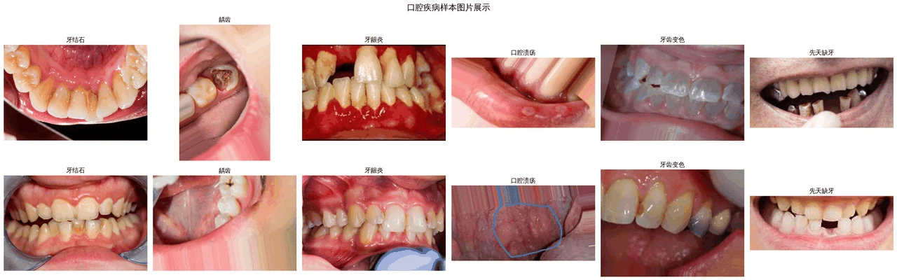 口腔疾病样本