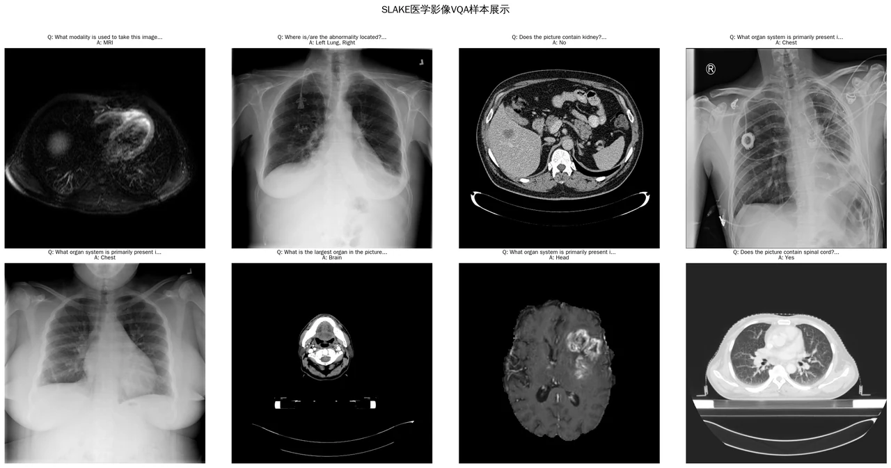 SLAKE 医学影像 VQA 样本
