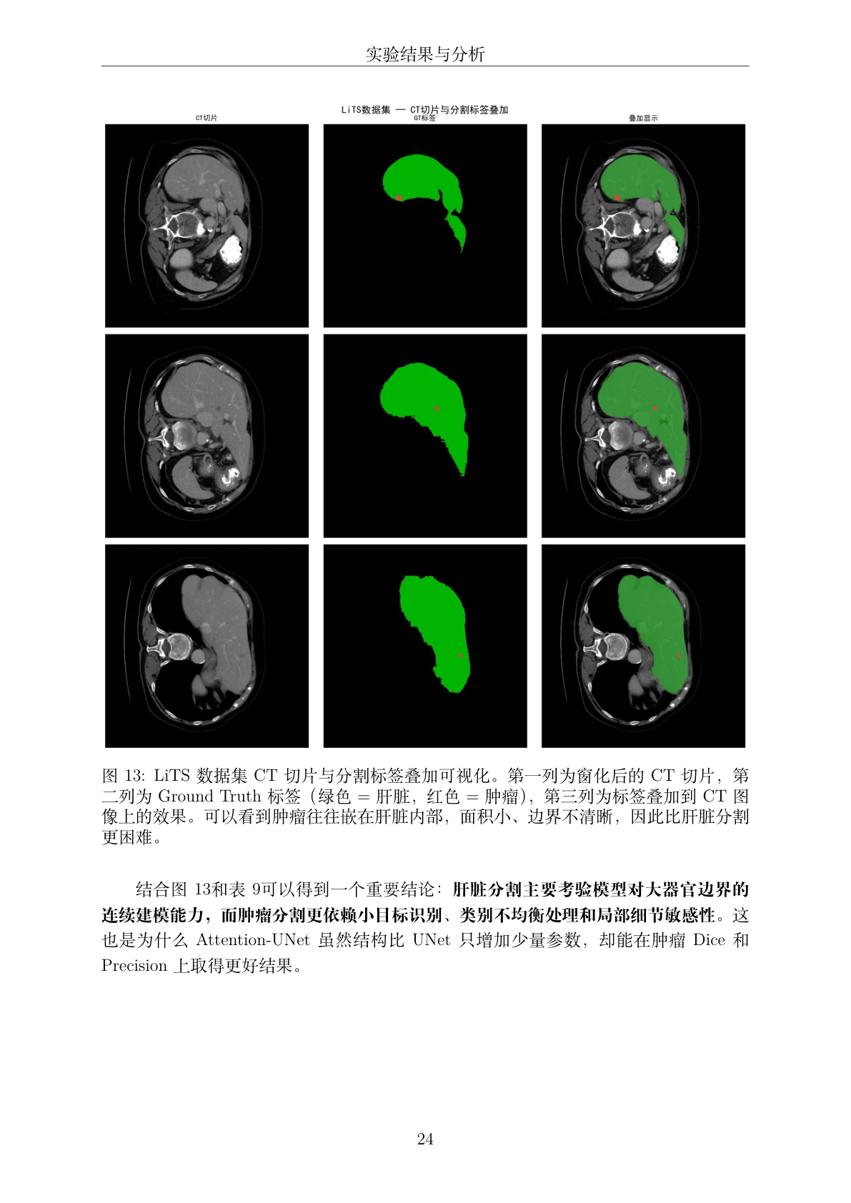 结果页