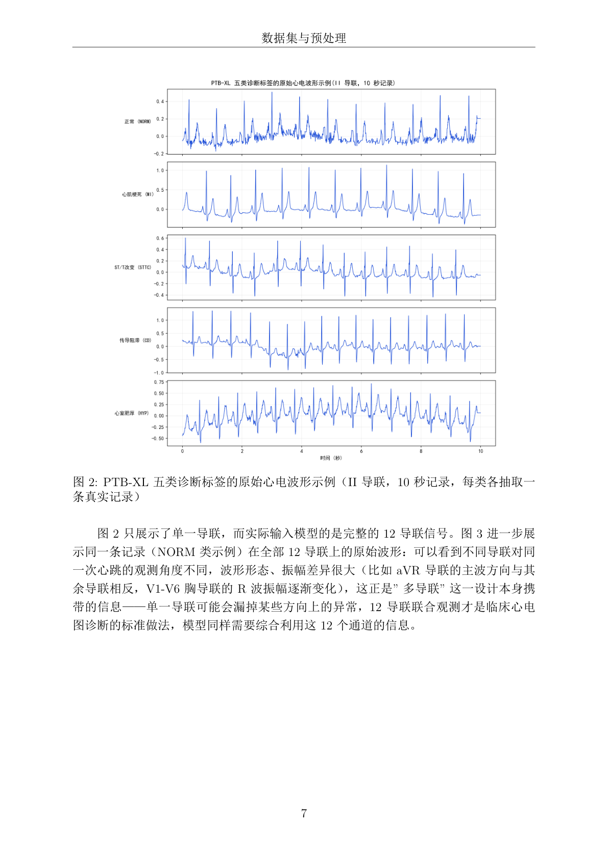 技术文档·数据集章节原始波形展示页